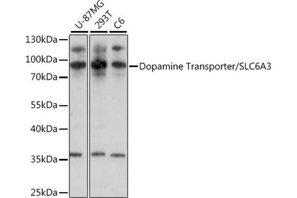 SLC6A3 antibody  (C-Term)