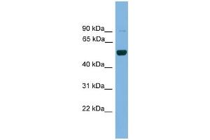 WB Suggested Anti-Irx2 Antibody Titration: 0.