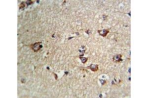 IHC analysis of FFPE human brain tissue stained with CD71 antibody (Transferrin Receptor antibody  (AA 649-677))