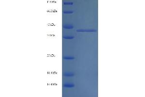 SDS-PAGE (SDS) image for Aldolase B, Fructose-Bisphosphate (ALDOB) (AA 2-364) protein (His tag) (ABIN4974994)