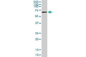 AKT3 monoclonal antibody (M06), clone 2H4. (AKT3 antibody  (AA 100-189))