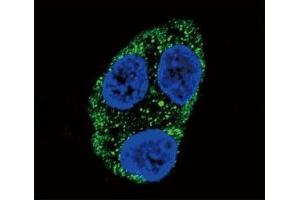 Confocal immunofluorescent analysis of Tyrosinase antibody with HepG2 cells followed by Alexa Fluor 488-conjugated goat anti-rabbit lgG (green). (TYR antibody  (AA 486-513))
