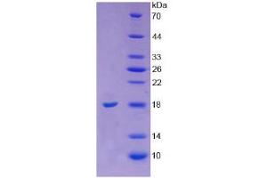 SDS-PAGE analysis of Cow Angiogenin Protein. (ANG Protein)
