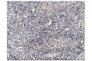 IHC analysis of Ornithine Aminotransferase/OAT using anti-Ornithine Aminotransferase/OAT antibody (ABIN7600649). (OAT antibody  (AA 214-439))