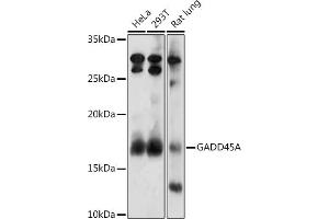 Western blot analysis of extracts of various cell lines, using GA antibody (ABIN3022563, ABIN3022564, ABIN3022565, ABIN1679943 and ABIN6218905) at 1:1000 dilution. (GADD45A antibody  (AA 1-165))