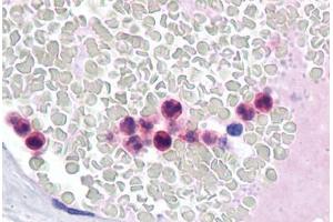 Human Neutrophils: Formalin-Fixed, Paraffin-Embedded (FFPE) (IRF4 antibody  (AA 342-452))