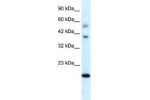 Human heart; WB Suggested Anti-CGI-143 Antibody Titration: 0. (BOLA1 antibody  (N-Term))