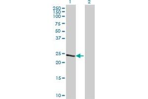 Western Blot analysis of TCEAL1 expression in transfected 293T cell line by TCEAL1 monoclonal antibody (M20), clone 2B5.