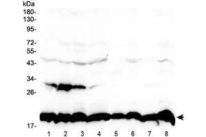 Western blot testing of 1) human placenta, 2) human U-87MG, 3) human HeLa, 4) mouse HEPA1-6, 5) rat PC-12, 6) rat RH35, 7) mouse NIH3T3 and 8) mouse SP20 lysate with Cyclophilin B antibody at 0. (PPIB antibody)