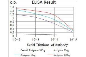 Black line: Control Antigen (100 ng), Purple line: Antigen(10 ng), Blue line: Antigen (50 ng), Red line: Antigen (100 ng), (PDE1B antibody  (AA 370-536))
