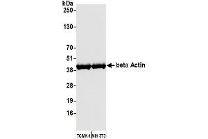 Western Blotting (WB) image for anti-Cytoskeletal Actin (CIMG_00972) (AA 1-50) antibody (ABIN7449436) (Recombinant Cytoskeletal Actin (CIMG_00972) (AA 1-50) antibody)