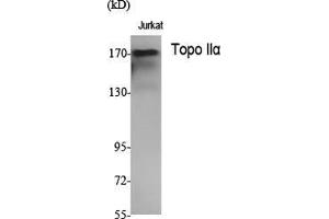 Western Blot (WB) analysis of specific cells using Topo IIalpha Polyclonal Antibody. (Topo IIalpha (N-Term) antibody)