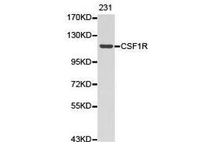 Western Blotting (WB) image for anti-Colony Stimulating Factor 1 Receptor (CSF1R) antibody (ABIN1872025) (CSF1R antibody)