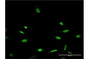 Immunofluorescence of monoclonal antibody to CRX on HeLa cell.