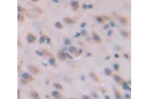 Figure. (SIK2 antibody  (AA 674-916))
