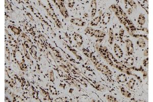 ABIN6277218 at 1/100 staining Human kidney tissue by IHC-P. (EPB41 antibody  (Internal Region))