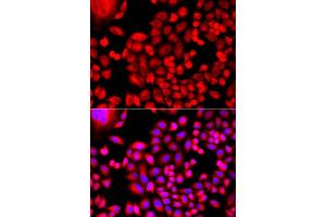 Immunofluorescence analysis of A549 cell using MTHFD1L antibody. (MTHFD1L antibody)