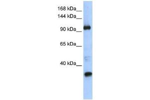 Western Blotting (WB) image for anti-Terminal Uridylyl Transferase 1, U6 SnRNA-Specific (TUT1) antibody (ABIN2458418)