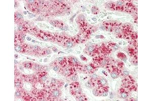 Formalin-fixed and paraffin-embedded H. (NMNAT3 antibody  (AA 150-178))