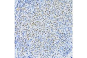 Immunohistochemistry of paraffin-embedded rat spleen using SNRNP70 antibody. (SNRNP70 antibody  (AA 150-250))