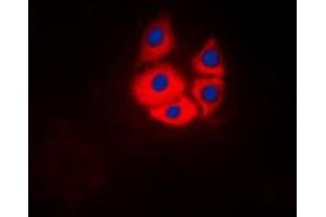 Immunofluorescent analysis of MARK4 staining in Jurkat cells. (MARK4 antibody  (Center))