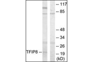 Western blot analysis of extracts from HuvEc cells using TFIP8 Antibody . (TNFAIP8 antibody)