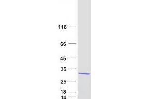 Validation with Western Blot (SAR1B Protein (Transcript Variant 1) (Myc-DYKDDDDK Tag))