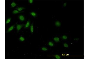 Immunofluorescence of monoclonal antibody to CASP9 on HeLa cell. (Caspase 9 antibody  (AA 1-416))