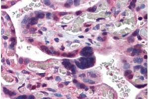 Human Placenta: Formalin-Fixed, Paraffin-Embedded (FFPE) (CAND1 antibody  (C-Term))
