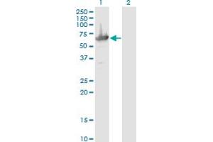 Western Blot analysis of MCCC2 expression in transfected 293T cell line by MCCC2 monoclonal antibody (M05), clone 2B3. (MCCC2 antibody  (AA 456-563))