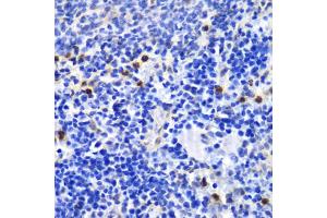 Immunohistochemistry of paraffin-embedded mouse spleen using ANXA1 antibody. (Annexin a1 antibody)