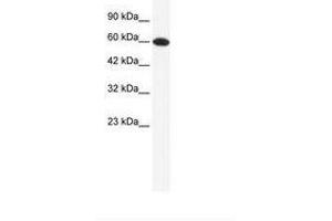 Image no. 1 for anti-DEAD (Asp-Glu-Ala-Asp) Box Polypeptide 6 (DDX6) (AA 74-123) antibody (ABIN202614)