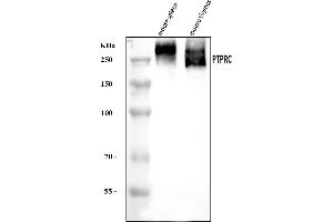 Western blot analysis of CD45/Ptprc using anti-CD45/Ptprc antibody (ABIN7600589).