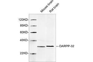 Western blot analysis of tissue lysates using 1 µg/mL DARPP-32 Antibody, pAb, Rabbit (ABIN398905) The signal was developed with IRDyeTM 800 Conjugated Goat Anti-Rabbit IgG. (DARPP32 antibody  (AA 150-200))