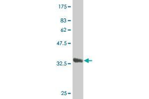 Western Blotting (WB) image for anti-Ceramide Synthase 6 (CERS6) (AA 62-131) antibody (ABIN531439)