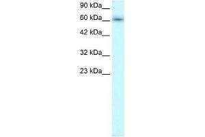 Human Raji; WB Suggested Anti-TRAFD1 Antibody Titration: 0. (TRAFD1 antibody  (C-Term))