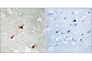 Immunohistochemistry analysis of paraffin-embedded human brain, using p19 INK4d Antibody. (CDKN2D antibody  (AA 96-145))