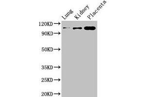 Western Blot Positive WB detected in: Mouse lung tissue, Mouse kidney tissue, Human placenta tissue All lanes: MSH4 antibody at 3 μg/mL Secondary Goat polyclonal to rabbit IgG at 1/50000 dilution Predicted band size: 105 kDa Observed band size: 105 kDa