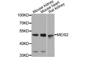 Western blot analysis of extracts of various cells, using MEIS2 antibody. (MEIS2 antibody)