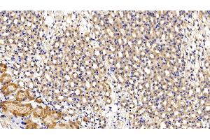 Immunohistochemistry (IHC) image for anti-Interleukin 6 Signal Transducer (Gp130, Oncostatin M Receptor) (IL6ST) (AA 238-500) antibody (ABIN7430555)