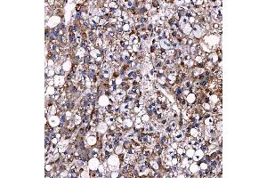 IHC analysis of TTC7B using anti-TTC7B antibody (ABIN7601050). (TTC7B antibody  (AA 275-730))