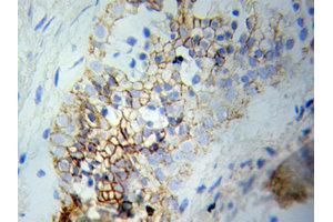 Immunohistochemistry (IHC) image for anti-Mitogen-Activated Protein Kinase 1 (MAPK1) (N-Term) antibody (ABIN1873622) (ERK2 antibody  (N-Term))