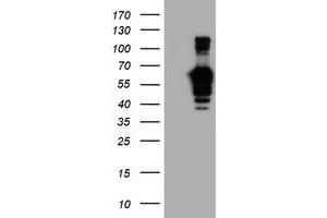 HEK293T cells were transfected with the pCMV6-ENTRY control (Left lane) or pCMV6-ENTRY GOLM1 (Right lane) cDNA for 48 hrs and lysed. (GOLM1 antibody)