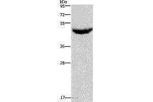 Western blot analysis of Human serum solution, using CXCR2 Polyclonal Antibody at dilution of 1:125 (CXCR2 antibody)