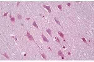 Anti-EFNA5 / Ephrin A5 antibody IHC staining of human brain, cortex neurons.