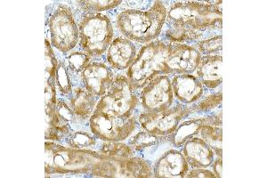 Immunohistochemistry of paraffin-embedded rat kidney using RPL13 Rabbit mAb (ABIN7269993) at dilution of 1:50 (40x lens). (RPL13 antibody)