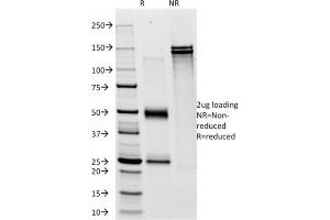 SDS-PAGE Analysis Purified CD28 Mouse Monoclonal Antibody (C28/76). (CD28 antibody)