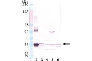 Western blot analysis of HO-2, pAb: Lane 1: MW marker, Lane 2: HO-2 Recombinant Human Protein , Lane 3: Human Liver Microsome Extract, Lane 4: Mouse Liver Microsome Extract, Lane 5: Rat Liver Microsome Extract, Lane 6: Dog Liver Microsome Extract. (HMOX2 antibody  (N-Term))