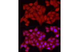Immunofluorescence analysis of HeLa cells using [KO Validated] PTPN2 Rabbit pAb (ABIN3022584, ABIN3022585, ABIN3022586, ABIN1513448 and ABIN6218927) at dilution of 1:250 (40x lens). (PTPN2 antibody  (AA 1-353))