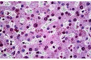 Human Liver: Formalin-Fixed, Paraffin-Embedded (FFPE) (SGK1 antibody  (AA 1-91))